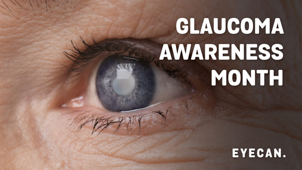 Close up image of an eye with Glaucoma